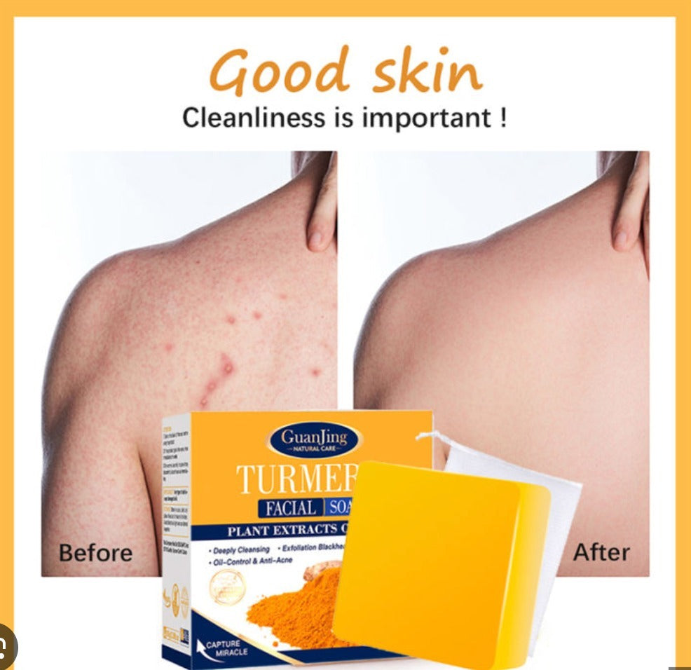 JABON TURMERIC CÚRCUMA